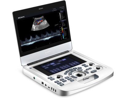 Edan Acclarix AX2 Vet Ultrasound System