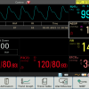 Edan X10 10" Veterinary Multiparameter Monitor