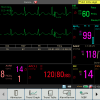 Edan X12 12"Veterinary Multiparameter Monitor